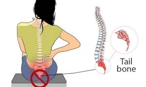 Tail Bone Pain Treatment