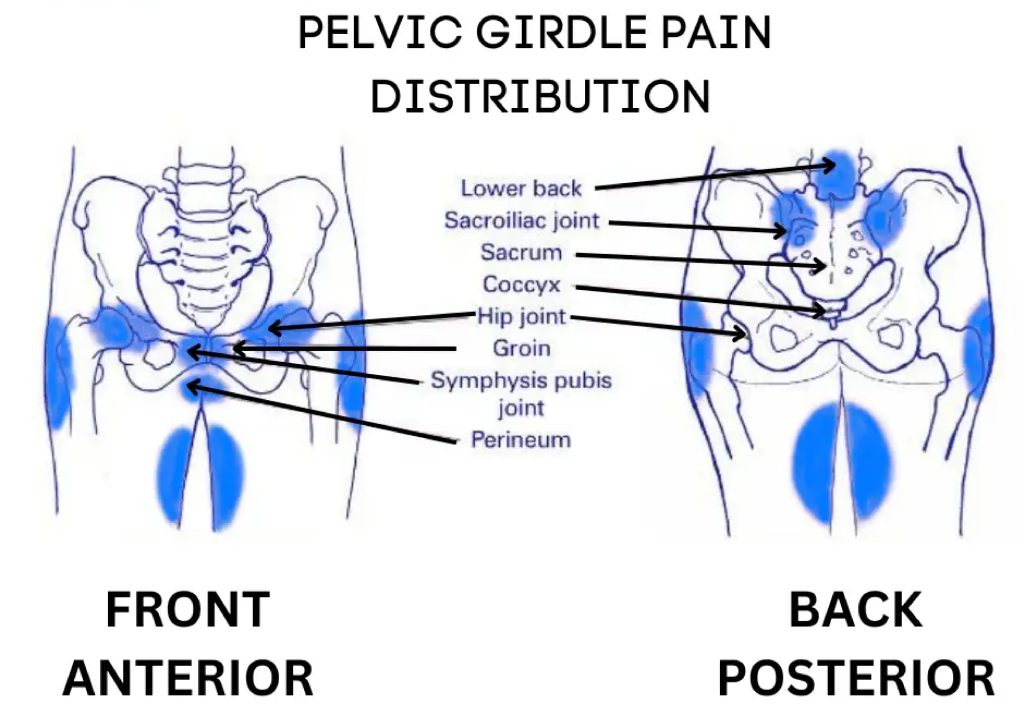 Pregnancy-related Pelvic Girdle Pain